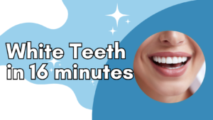 Read more about the article Have white teeth in 16 minutes